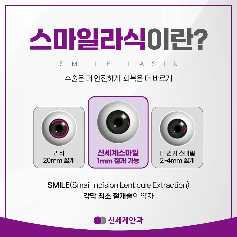 스마일라식이란 최소 절개