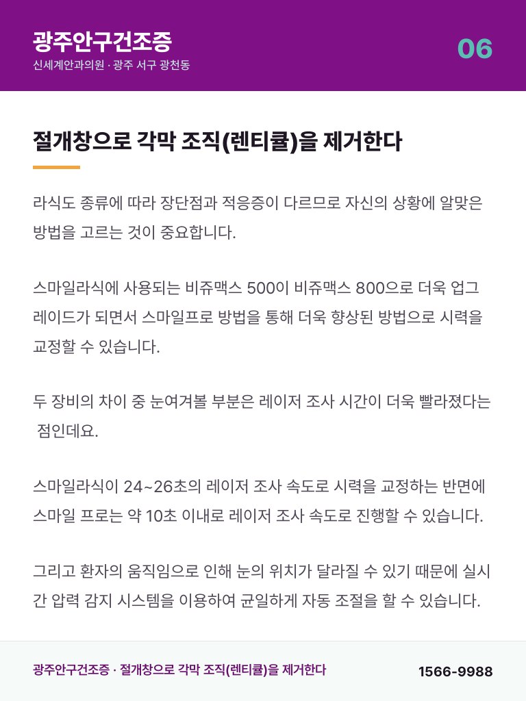 광주안구건조증 - 6